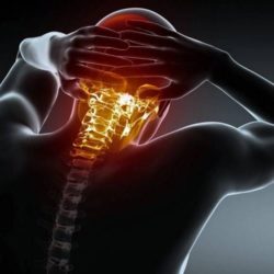 CERVICALGIA