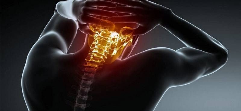 CERVICALGIA CERVICALGIA